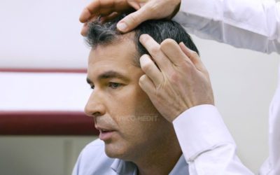 Cure anticaduta per capelli