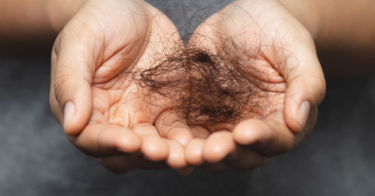 I segnali preoccupanti di una caduta eccessiva dei capelli